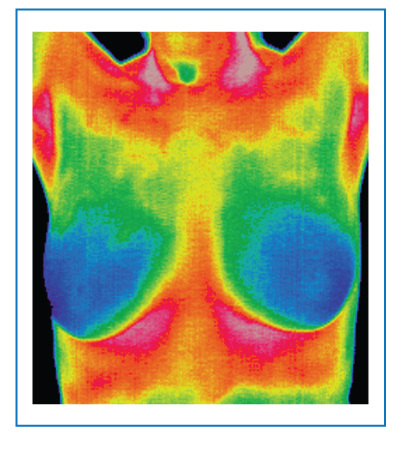 Seeing is Believing Breast Thermal Image in Rainbow